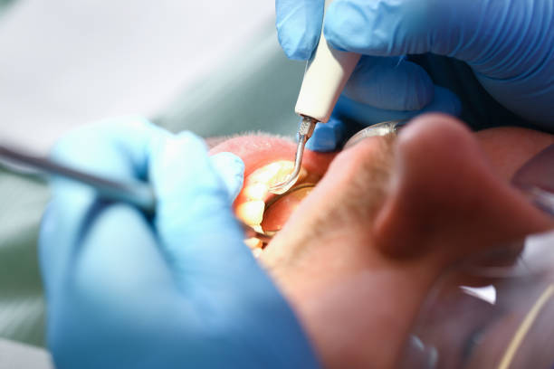 Best Emergency Orthodontic Repairs in Romeo, MI